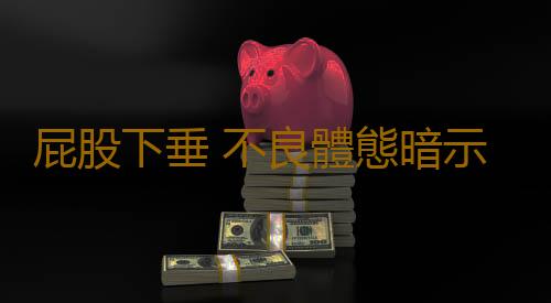 屁股下垂 不良體態暗示健康問題